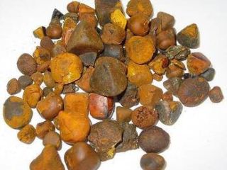 Los cálculos biliares GALLSTONES se utilizan en la medicina