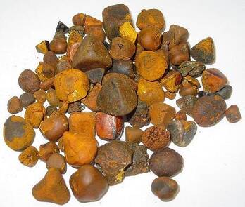 Los cálculos biliares GALLSTONES se utilizan en la medicina alternativa para tratar la hepatitis y otras dolencias relacionadas con el hígado y la vesícula
